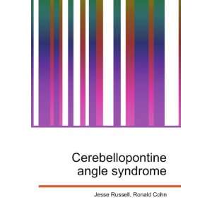  Cerebellopontine angle syndrome Ronald Cohn Jesse Russell 