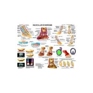 Equine Navicular Syndrome Anatomy Chart  Industrial 