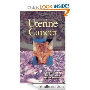 Uterine Cancer David M. Luesley, Frank Lawton, Andrew Berchuck 